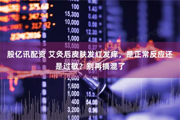股亿讯配资 艾灸后皮肤发红发痒，是正常反应还是过敏？别再搞混了